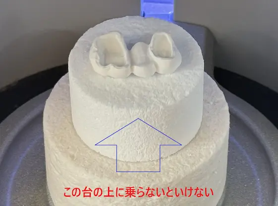 CEREC Speed Fireにジルコニアブリッジを設置している写真