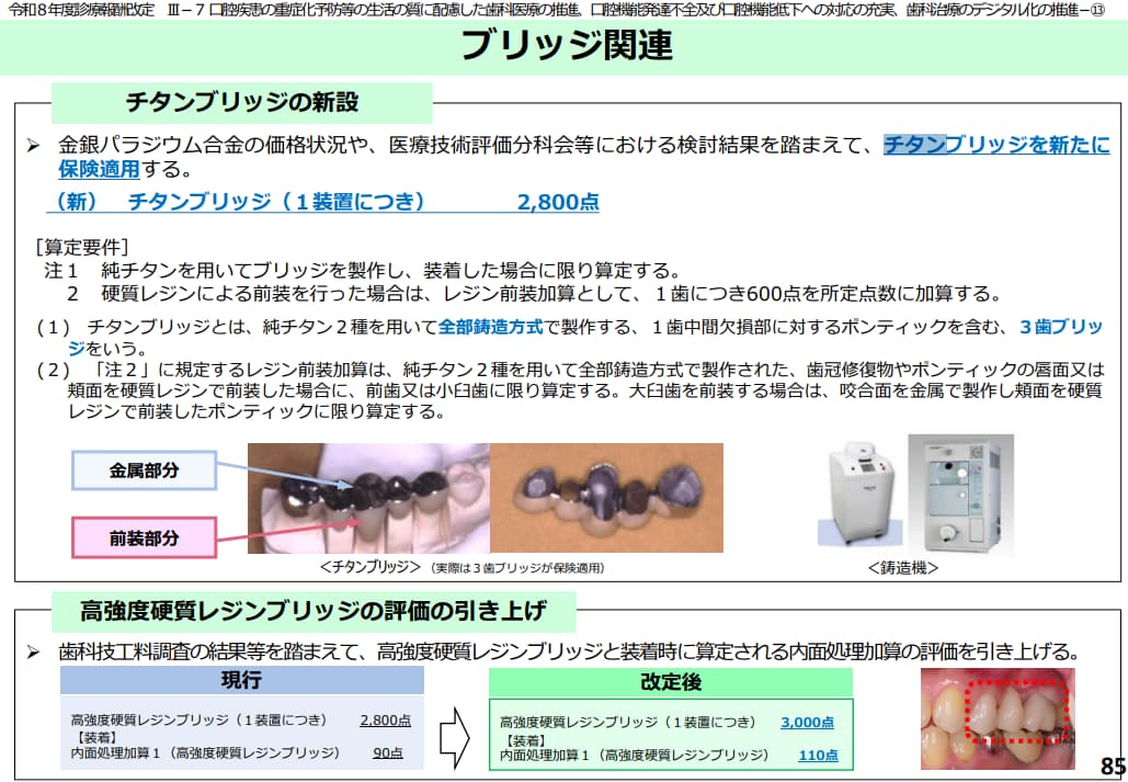 チタンブリッジの新規保険収載について