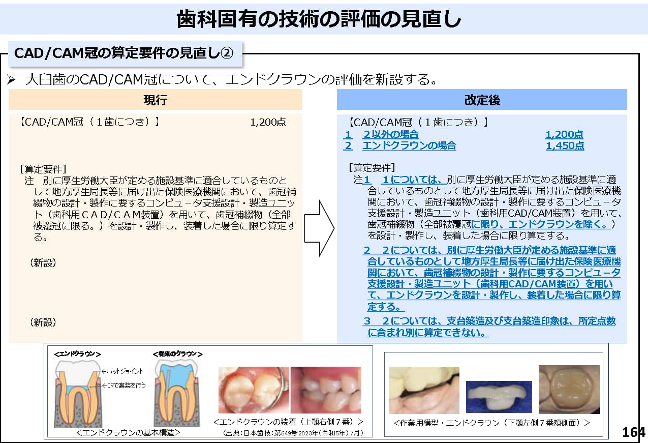 保険治療で出来る白い被せ物｜CAD/CAM冠 | 八島歯科クリニック