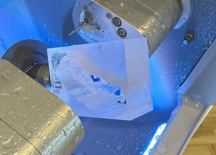 セレックガイドブロックを加工してサージカルガイドを製作