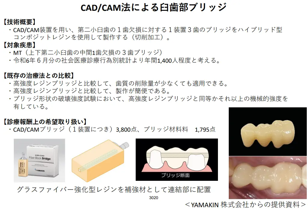 一体型CAD/CAMブリッジ（ファイバー補強有り）の写真付き資料