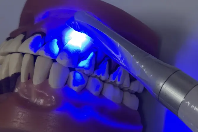 CRを光照射で硬化させる写真