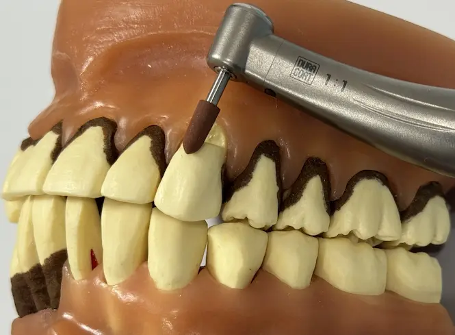 CRの形態修正と研磨をしている写真