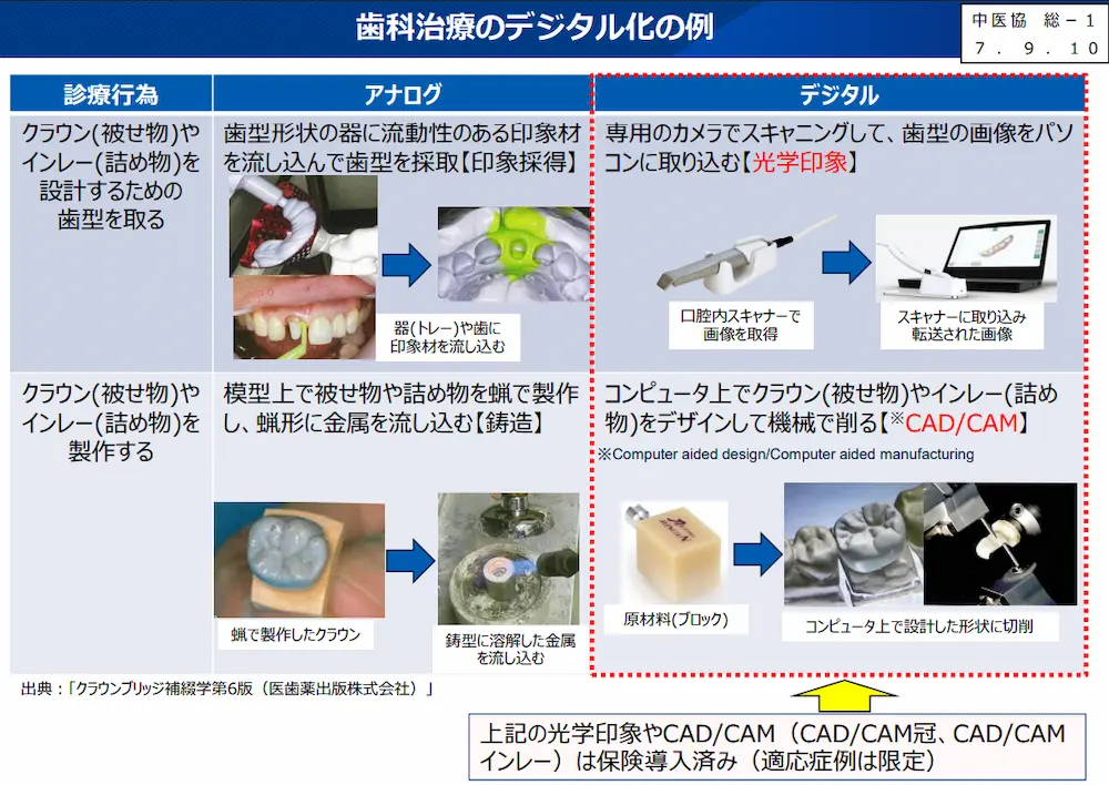 金歯 端材 インレー インレー | インプラント・根管治療