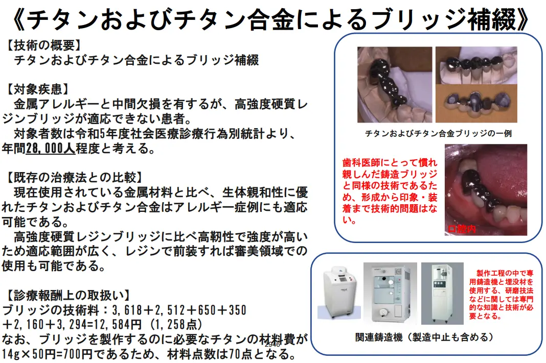 チタンおよびチタン合金によるブリッジ補綴の写真資料