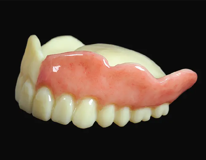 一体型プリント・デンチャーの写真