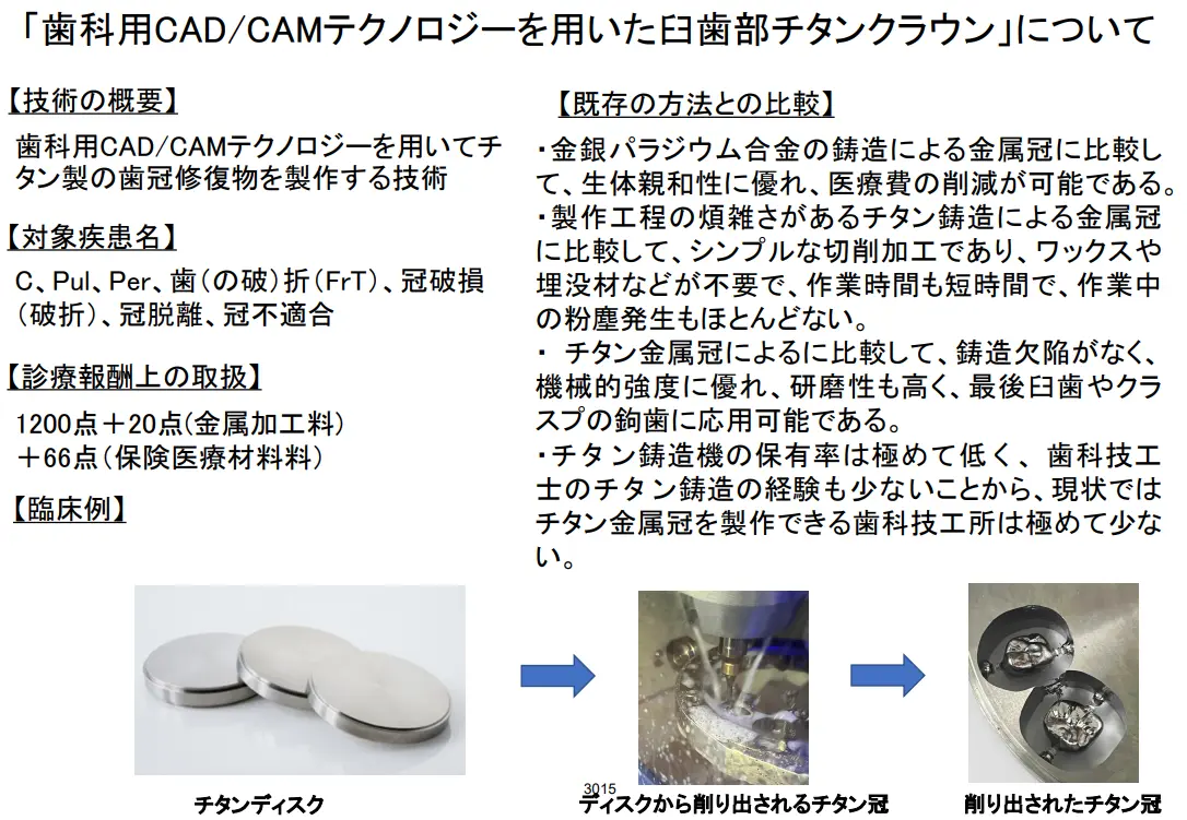 CAD/CAMによる臼歯部チタンクラウン製造に関する写真付き資料